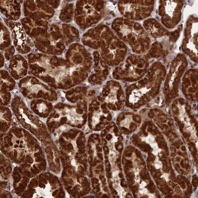 Immunohistochemistry-Paraffin: CRTAP Antibody [NBP1-94105]