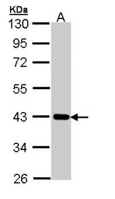 Western Blot: CRTAP Antibody [NBP1-32884]