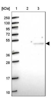 Western Blot: CRTAP Antibody [NBP1-94105]