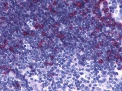 Immunohistochemistry-Paraffin: CRTH-2/GPR44 Antibody - BSA Free [NBP1-02355]