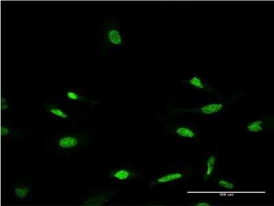 Immunocytochemistry/ Immunofluorescence: CRX/CORD2 Antibody (4A12) [H00001406-M06]