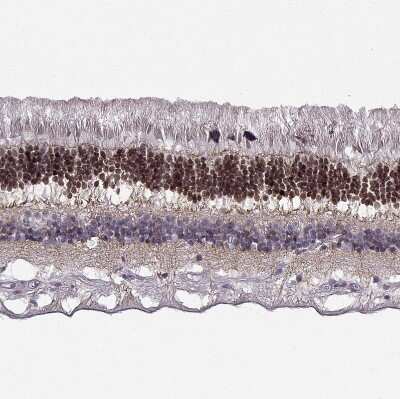 Immunohistochemistry-Paraffin: CRX/CORD2 Antibody [NBP1-88059]