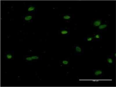 Immunocytochemistry/ Immunofluorescence: CRY1 Antibody (2G4-1F6) [H00001407-M02]