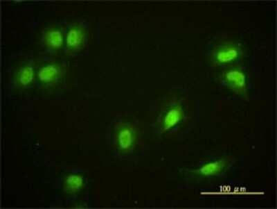 Immunocytochemistry/ Immunofluorescence: CRY1 Antibody (4H4-1C4) [H00001407-M01]