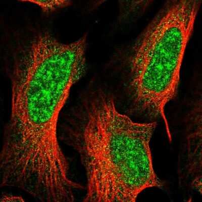 Immunocytochemistry/ Immunofluorescence: CRY2 Antibody [NBP1-86273]