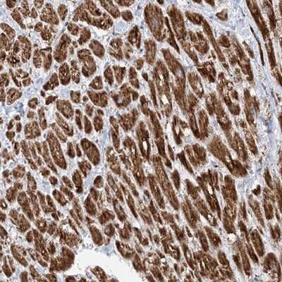 Immunohistochemistry-Paraffin: CRY2 Antibody [NBP1-86273]