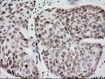Immunohistochemistry: CRY2 Antibody (OTI1H5) - Azide and BSA Free [NBP2-70449]