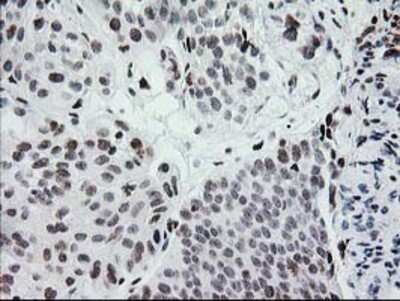 Immunohistochemistry: CRY2 Antibody (OTI1H5) - Azide and BSA Free [NBP2-70449]