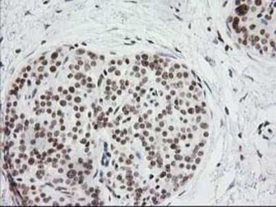 Immunohistochemistry: CRY2 Antibody (OTI1H5) - Azide and BSA Free [NBP2-70449]