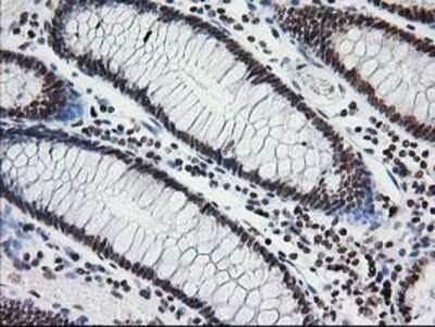 Immunohistochemistry: CRY2 Antibody (OTI1H5) - Azide and BSA Free [NBP2-70449]