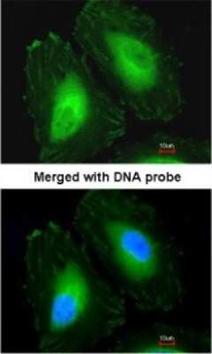 Immunocytochemistry/ Immunofluorescence: CRYBA4 Antibody [NBP1-32741]