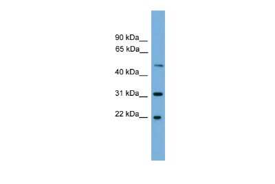 Western Blot: CRYBA4 Antibody [NBP2-87215]