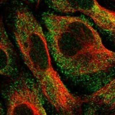 Immunocytochemistry/ Immunofluorescence: CRYGA Antibody [NBP3-17113]