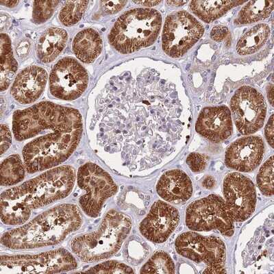 Immunohistochemistry-Paraffin: CRYGN Antibody [NBP2-14708]