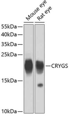 Western Blot: CRYGS AntibodyBSA Free [NBP2-92525]