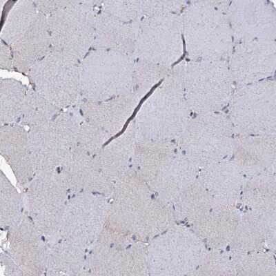 Immunohistochemistry-Paraffin: CRYL1 Antibody [NBP1-93718]