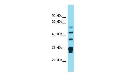Western Blot: CRYL1 Antibody [NBP2-82773]