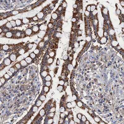 Immunohistochemistry-Paraffin: CRYZ Antibody [NBP1-89533]