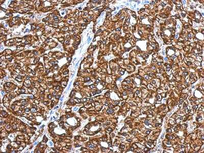 Immunohistochemistry-Paraffin: CRYZ Antibody [NBP2-16017]
