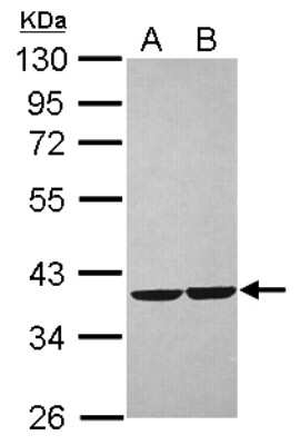 Western Blot: CRYZ Antibody [NBP2-16017]