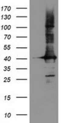 Western Blot: CRYZL1 Antibody (OTI2F9) [NBP2-02012]