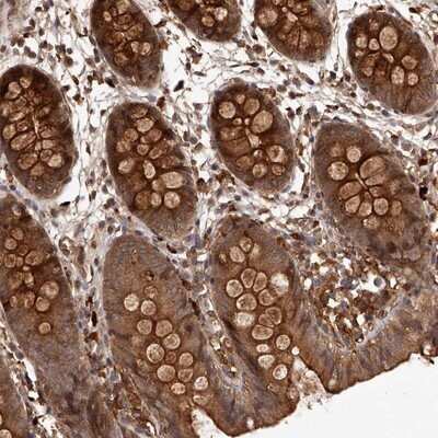 Immunohistochemistry-Paraffin: CRYZL1 Antibody [NBP1-89363]