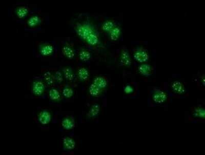Immunocytochemistry/ Immunofluorescence: CRYZL1 Antibody (OTI2F9) - Azide and BSA Free [NBP2-71522]