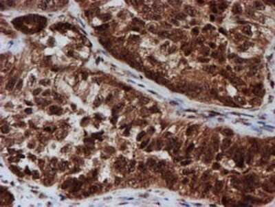 Immunohistochemistry: CRYZL1 Antibody (OTI2F9) - Azide and BSA Free [NBP2-71522]