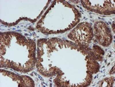 Immunohistochemistry: CRYZL1 Antibody (OTI2F9) - Azide and BSA Free [NBP2-71522]