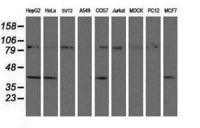 Western Blot: CRYZL1 Antibody (OTI2F9)Azide and BSA Free [NBP2-71522]