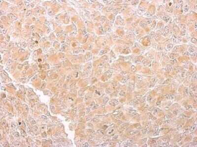 Immunohistochemistry-Paraffin: CS Citrate Synthase Antibody (1761) [NBP2-43648]