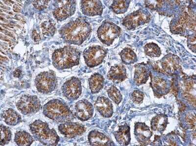 Immunohistochemistry-Paraffin: CS Citrate Synthase Antibody (1761) [NBP2-43648]