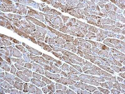Immunohistochemistry-Paraffin: CS Citrate Synthase Antibody (1761) [NBP2-43648]