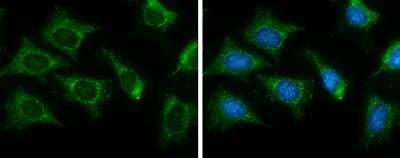 Immunocytochemistry/ Immunofluorescence: CS Citrate Synthase Antibody (2061) [NBP2-43649]