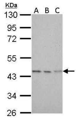 Western Blot: CS Citrate Synthase Antibody (2061) [NBP2-43649]