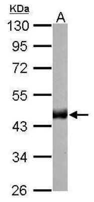 Western Blot: CS Citrate Synthase Antibody (2061) [NBP2-43649]