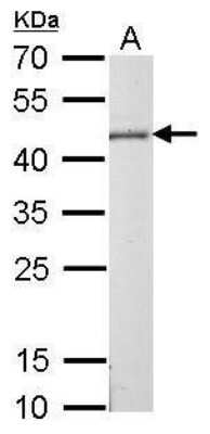 Western Blot: CS Citrate Synthase Antibody (2061) [NBP2-43649]
