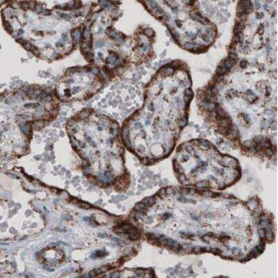 Immunohistochemistry-Paraffin: CS Citrate Synthase Antibody (CL2545) [NBP2-36771]