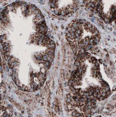 Immunohistochemistry: CS Citrate Synthase Antibody (CL2548) [NBP2-36772]