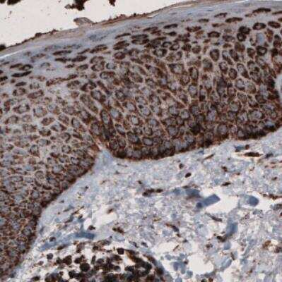 Immunohistochemistry: CS Citrate Synthase Antibody (CL2548) [NBP2-36772]