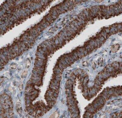 Immunohistochemistry: CS Citrate Synthase Antibody (CL2553) [NBP2-36773]