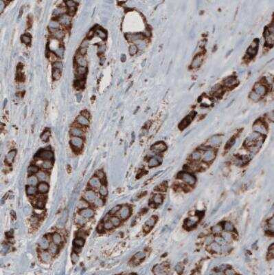 Immunohistochemistry: CS Citrate Synthase Antibody (CL2553) [NBP2-36773]