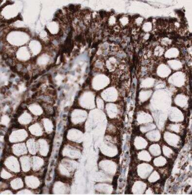 Immunohistochemistry: CS Citrate Synthase Antibody (CL2553) [NBP2-36773]