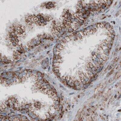 Immunohistochemistry: CS Citrate Synthase Antibody (CL2553) [NBP2-36773]
