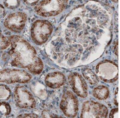 Immunohistochemistry: CS Citrate Synthase Antibody (CL2553) [NBP2-36773]