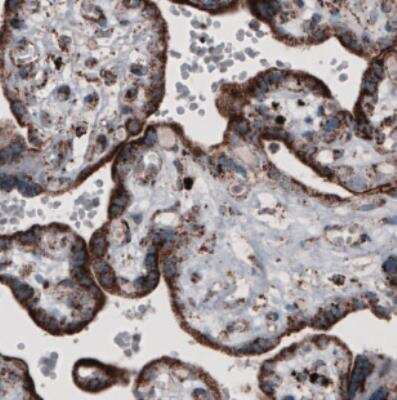 Immunohistochemistry: CS Citrate Synthase Antibody (CL2561) [NBP2-36774]