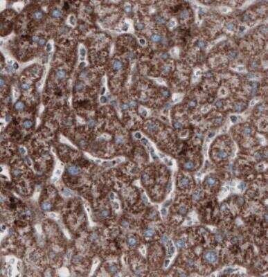 Immunohistochemistry: CS Citrate Synthase Antibody (CL2561) [NBP2-36774]