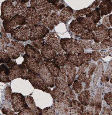 Immunohistochemistry: CS Citrate Synthase Antibody (CL2561) [NBP2-36774]