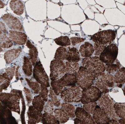 Immunohistochemistry: CS Citrate Synthase Antibody (CL2579) [NBP2-36775]