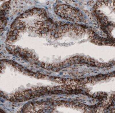 Immunohistochemistry: CS Citrate Synthase Antibody (CL2579) [NBP2-36775]
